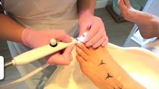 1 Tutorial NAIL MYCOSIS Solution  Imperial Feet Cosmetics [upl. by Kra822]