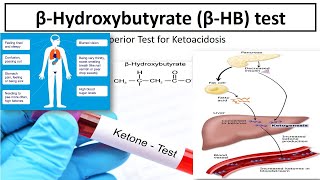 Beta Hydroxybutyrate testKetone body assayMedilabacademyBetaHbdiabeticketoacidosis [upl. by Eliath]