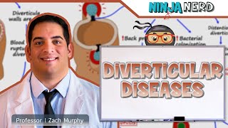 Diverticular Diseases  Clinical Medicine [upl. by Oconnor75]