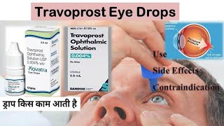 Travoprost Eye Drops  travoprost ip drops [upl. by Therron]