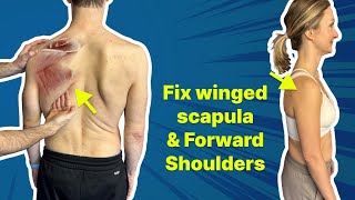 The 1 Exercise to Fix Winged Scapula amp Forward Shoulder  GET OUT of PAIN [upl. by Tillion]