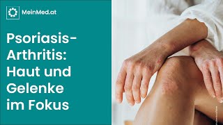 PsoriasisArthritis Entzündete Gelenke bei schuppender Haut [upl. by Roydd]