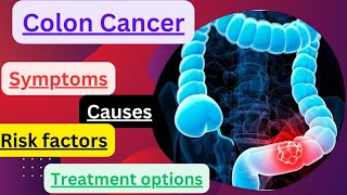 Colon cancer Symptoms Causes risk factors and Treatment options [upl. by Durant428]