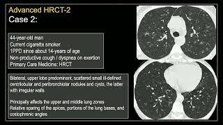 HRCT2 Diffuse SmokingRelated Lung Diseases [upl. by Aiela]