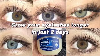 get longer healthy thicker eyelashes in just 2 days NATURALLY [upl. by Dagnah29]