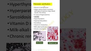 Shorts Pathological calcificationDr GSS SRM MCH RC [upl. by Acinaj]