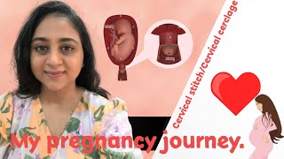 My pregnancy journey  Cervical cerclage Cervical stitch Surgery [upl. by Serilda]