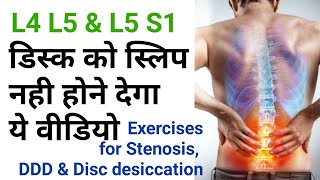 exercises for back pain Disc Dessication stenosis l4l5 l5s1 facet joint by dr sandeep Bhardwaj [upl. by Aneba]