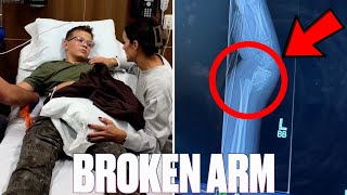 NOT WHAT WE MEANT BY FALL BREAK  BROKEN ARM  BOTH BONES BROKEN AT WRIST  BROKEN BONE ACCIDENT [upl. by Chiles]