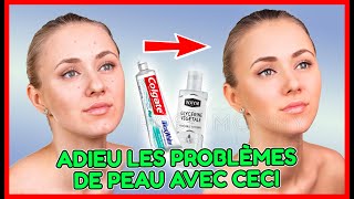 vaseline plus dentifrice pour soigner les problèmes de peau [upl. by Strickman]