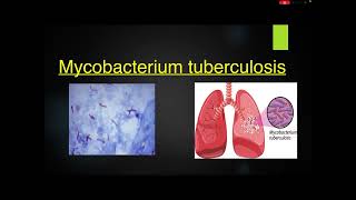 Pathogenesis of pulmonary tuberculosis [upl. by Enymsaj]