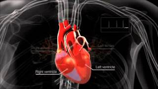 What is atrial fibrillation [upl. by Rehpotsrhc]