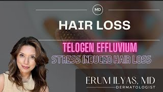 Telogen Effluvium  Stress Hair Loss [upl. by Anadroj]