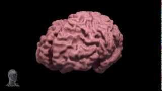 Alzheimers disease brain morph [upl. by Allie]