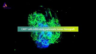 Revolutionizing the monitoring of CAR T cell therapies against solid tumors with the 3D imaging [upl. by Medora]