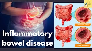 UPSC  Migraine  Inflammatory bowel disease IBD  UPSC Prelims 2024 science and tech [upl. by Naiviv570]