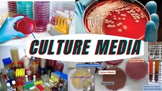 culture media  types of culture media  classification of culture media [upl. by Amapuna]