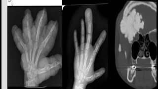 Msk spotters 2 radiology 15 cases in 15 minutes radiopedia mrictxrayultrasoundanazomybasics [upl. by Lucie]