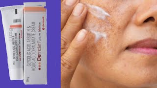 Demelan cream complete Information  Remove Pigmentation Acne scars Pimple marks [upl. by Lina]