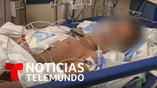 Coronavirus Aumentan casos de síndrome inflamatorio en niños en EEUU  Noticias Telemundo [upl. by Liakim]