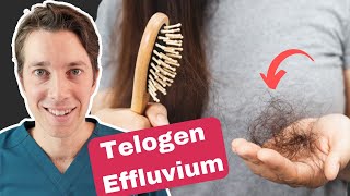 Telogen Effluvium Explained  Best Hair Shedding Treatments [upl. by Coleman]