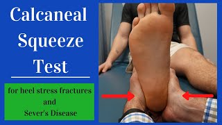 Calcaneal Squeeze Test Heel Squeeze [upl. by Asik]