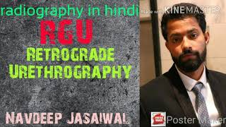 Retrograde urethrography RGU  radiography in hindi [upl. by Luciana]