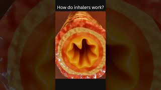 How do inhalers work [upl. by Romola]