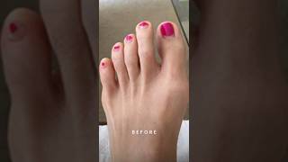 I Tried The Fascia Blaster On My Feet  Before And After Review [upl. by Kalmick]