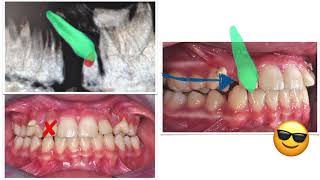 How not to manage Canine Ankylosis [upl. by Gillespie252]