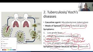 Bacterial Diseases Science ampTech upsc viralvideo pcs upsc [upl. by Nehr]