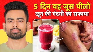 खून में जमा गन्दगी कैसे साफ़ करें  Purify Blood Naturally  Fit Tuber Hindi [upl. by Ahouh]