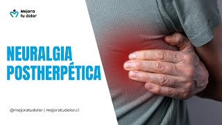 Neuralgia Postherpética  Mejora tu dolor [upl. by Saenihp]