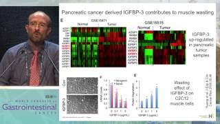 Cancer cachexia and sarcopenia in GI cancer Mechanism and ways to interfere with it [upl. by Bridget]