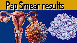 Pap Smear Results Explained under 3 minutes [upl. by Derfliw]