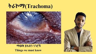 ለአይነ ስውርነት የሚዳርገው ትራኮማ Trachoma and its laboratory diagnosis Dr seife donkeytube Tenamedia [upl. by Angie]