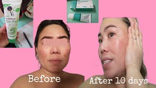 Pigmanorm and Facial Wash Review  Pangtanggal NG Pikas o Melasma  Ate Marian [upl. by Tartan]