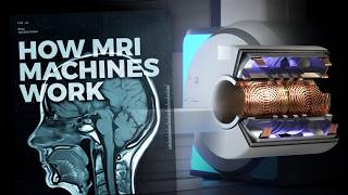 The Insane Engineering of MRI Machines [upl. by Haff530]