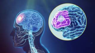 Repetitive Trancranial Magnetic Stimulation rTMS Physiology by Magstim [upl. by Tibbetts]