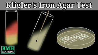 Kligler’s Iron Agar Test  KIA Test [upl. by Aerdno343]