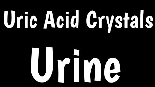 Uric Acid Crystals In Urine  Types Of Crystals In Urine  Microscopic Urine Examination [upl. by Evelc]