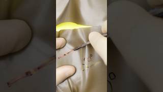 ZPlasty surgery suturing stitches vet medicine surgeon surgeonlife woundcare asmr funfact [upl. by Snell]