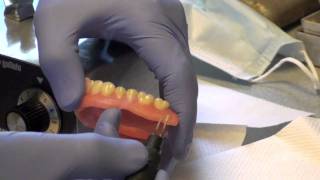 Denture Soft Reline Part 2 [upl. by Nylessoj]