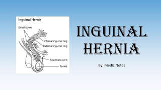 Inguinal hernia  direct vs indirect anatomy of inguinal canal deep ring occlusion test surgery [upl. by Arno]