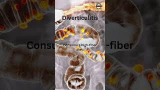 Diet For Diverticulitis [upl. by Moyers]