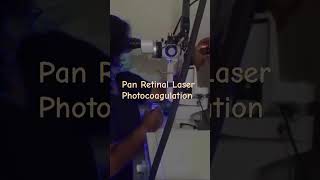 Retinal laser for diabetic retinopathy Panretinal Laser Photocoagulation retinalaser [upl. by Ninahs756]