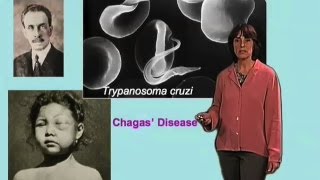 Chagas disease history  Norma Andrews University of Maryland [upl. by Macfadyn]