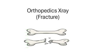 Orthopedics Xray।।Part1।।Fracture।।OSPE।।SOMC [upl. by Strenta]