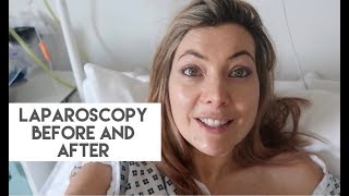 LAPAROSCOPY BEFORE AND AFTER WHY I WAS RUSHED BACK TO HOSPITAL [upl. by Ymma]