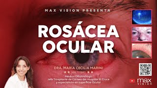 Dra María Cecilia Marini  Rosácea Ocular [upl. by Neeuq247]